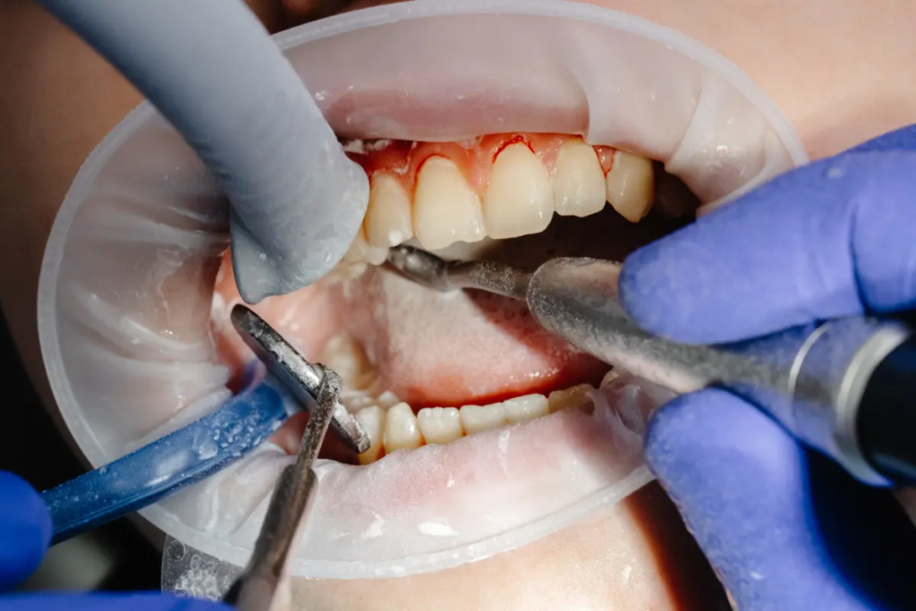 A dentist Alexandria VA can check for cancer when doing an oral screening. 