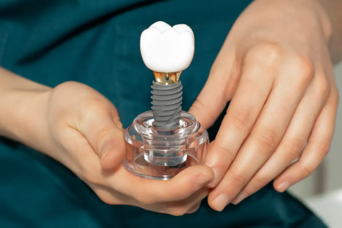 Questions to ask your dentist might also include asking about dental implants.