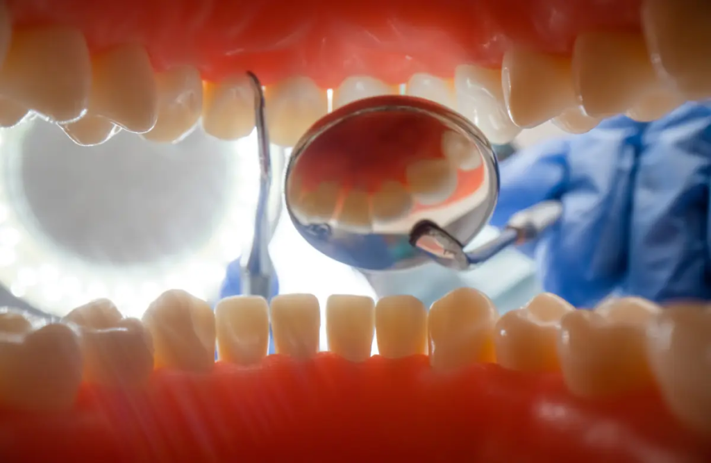 An inside view of a mouth that may or may not need a full mouth restoration Alexandria.