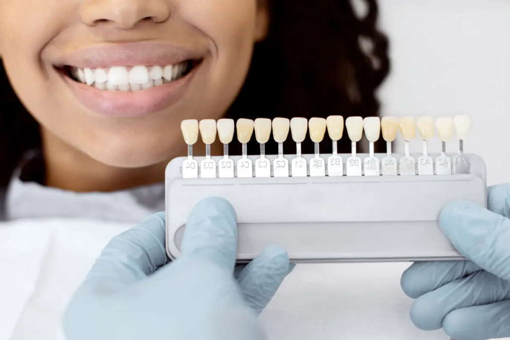 A smile patient getting veneers VA looks at a strip of color samples.