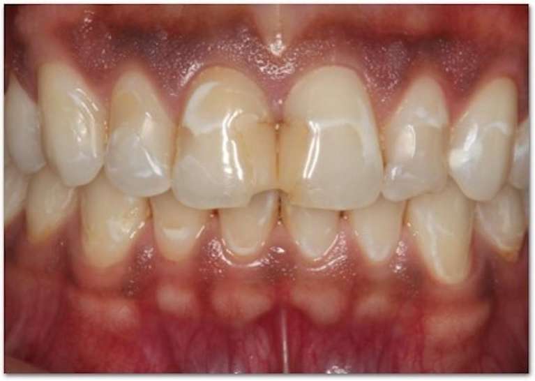 Close-up of human teeth and gums